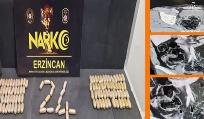 Erzincan'da Şaşırtan Operasyon: Midede Taşımışlar!